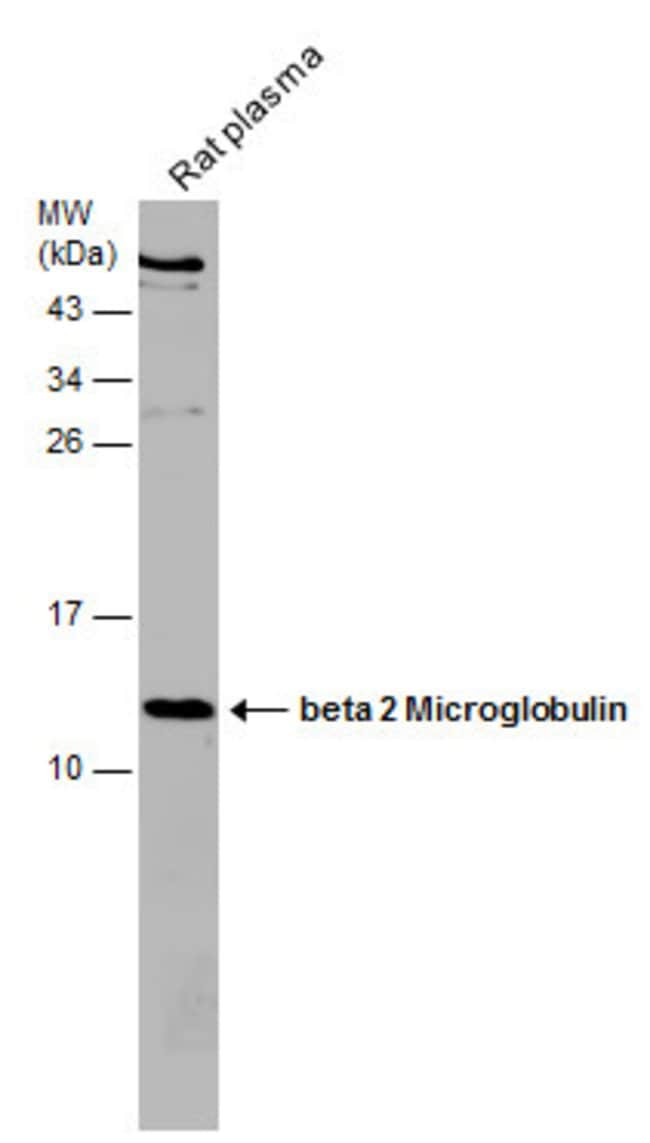 ANTI-BETA 2 MICROGLOBULIN