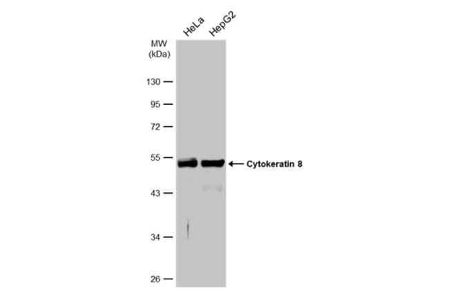 ANTI-CYTOKERATIN 8