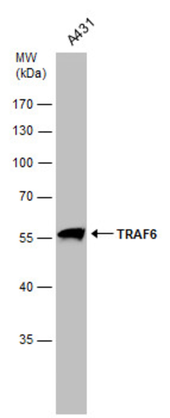 ANTI-TRAF6