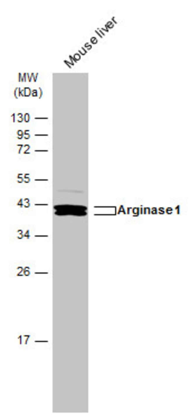 ANTI-ARGINASE I