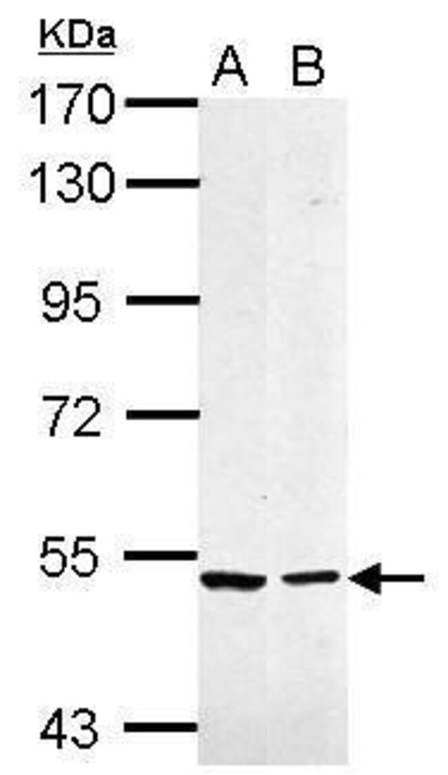 ANTI-CASPASE 10