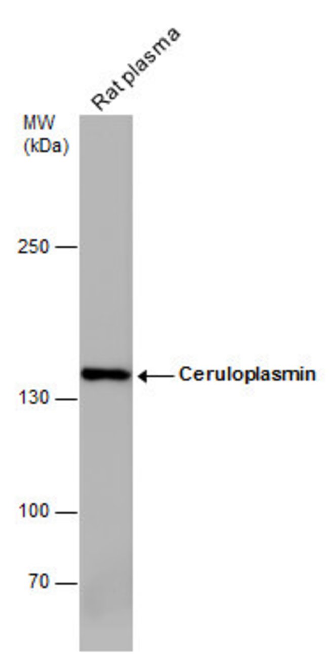 ANTI-CERULOPLASMIN