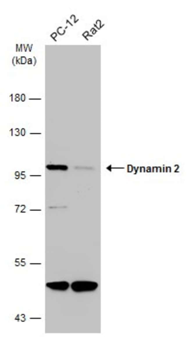 ANTI-DYNAMIN 2