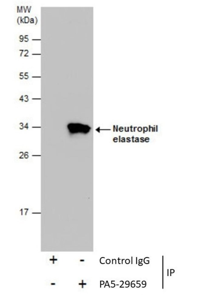 ANTI-ELASTASE (NEUTROPHIL)