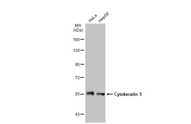 ANTI-CYTOKERATIN 5