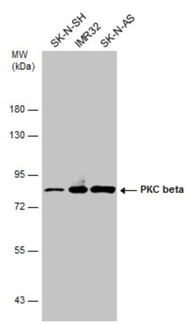 ANTI-PKC BETA