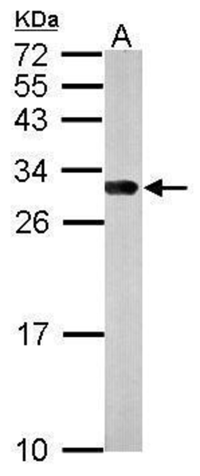 ANTI-14-3-3 GAMMA