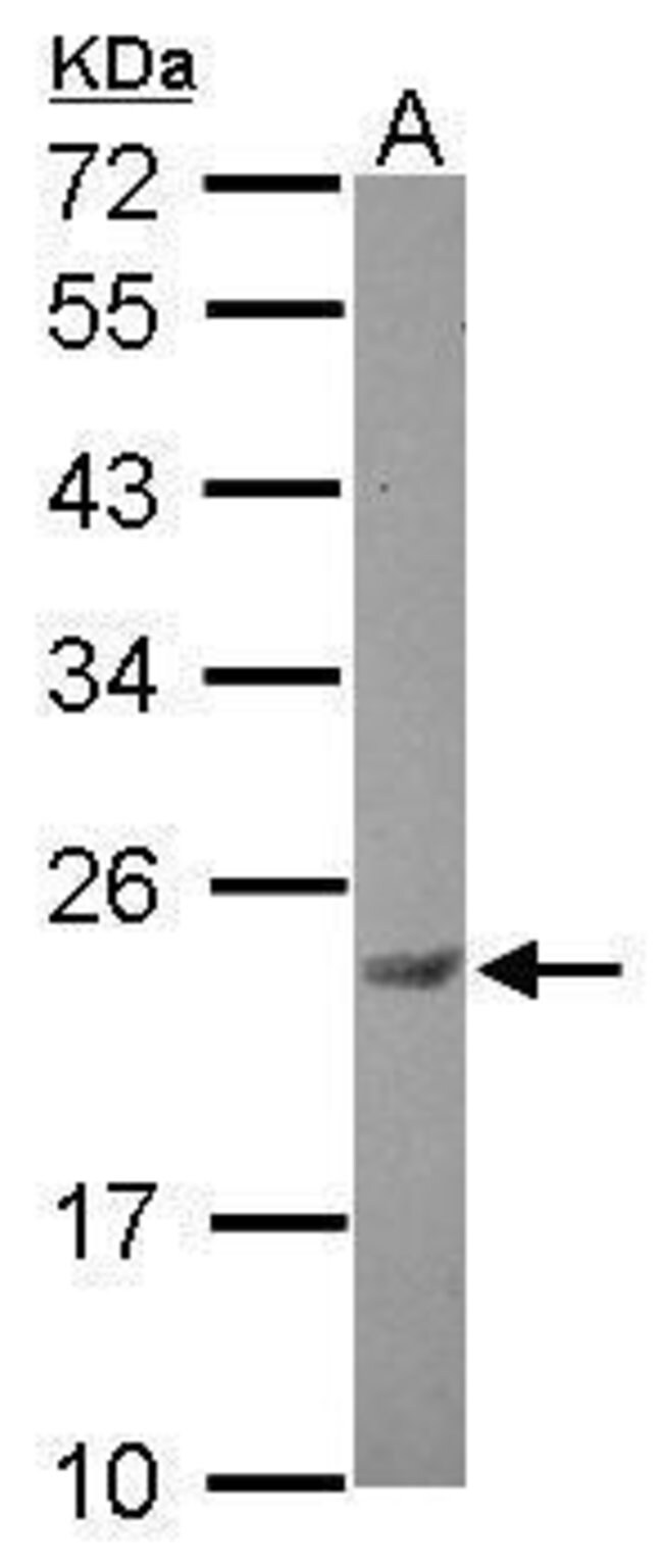 ANTI-CASEIN KINASE 2 BETA