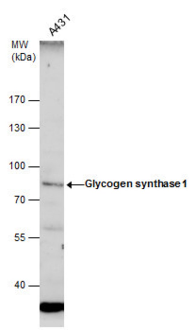 ANTI-GLYCOGEN SYNTHASE 1