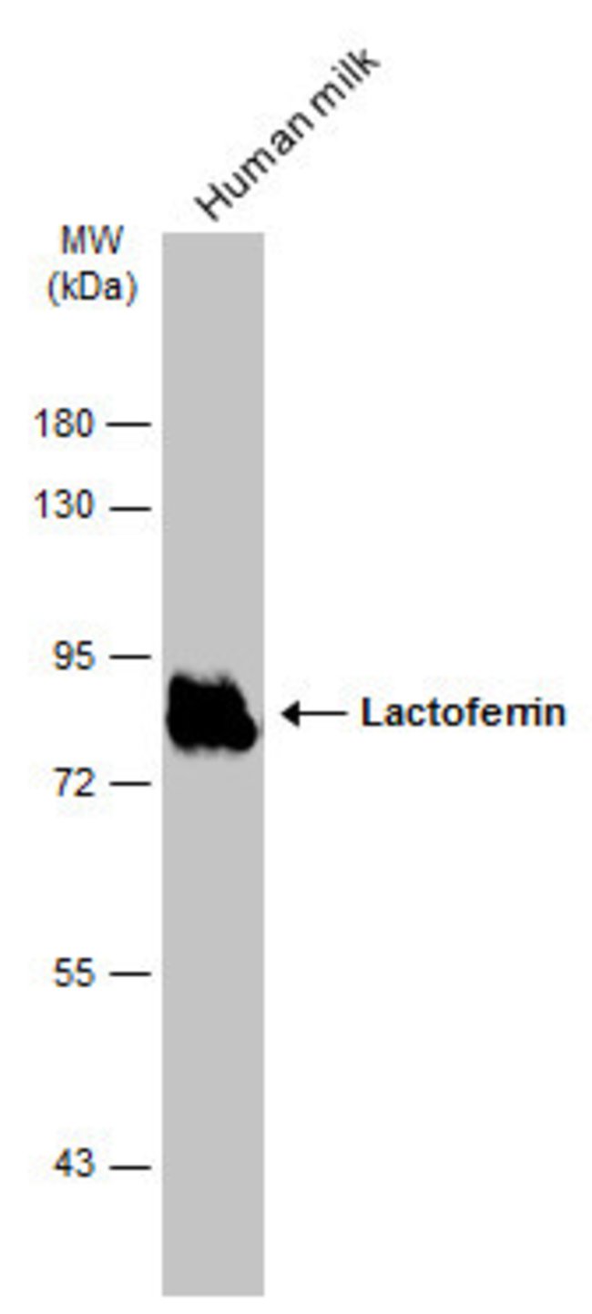 ANTI-LACTOFERRIN