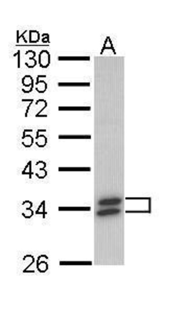 ANTI-SULT1A1