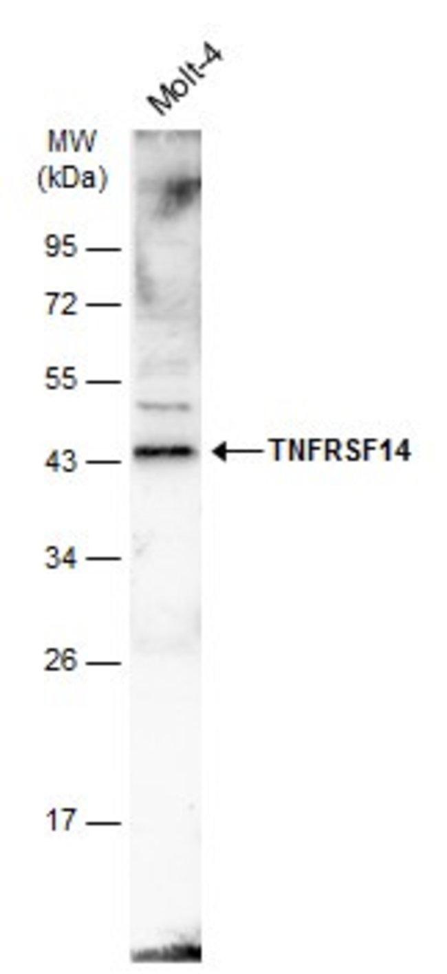 ANTI-TNFRSF14