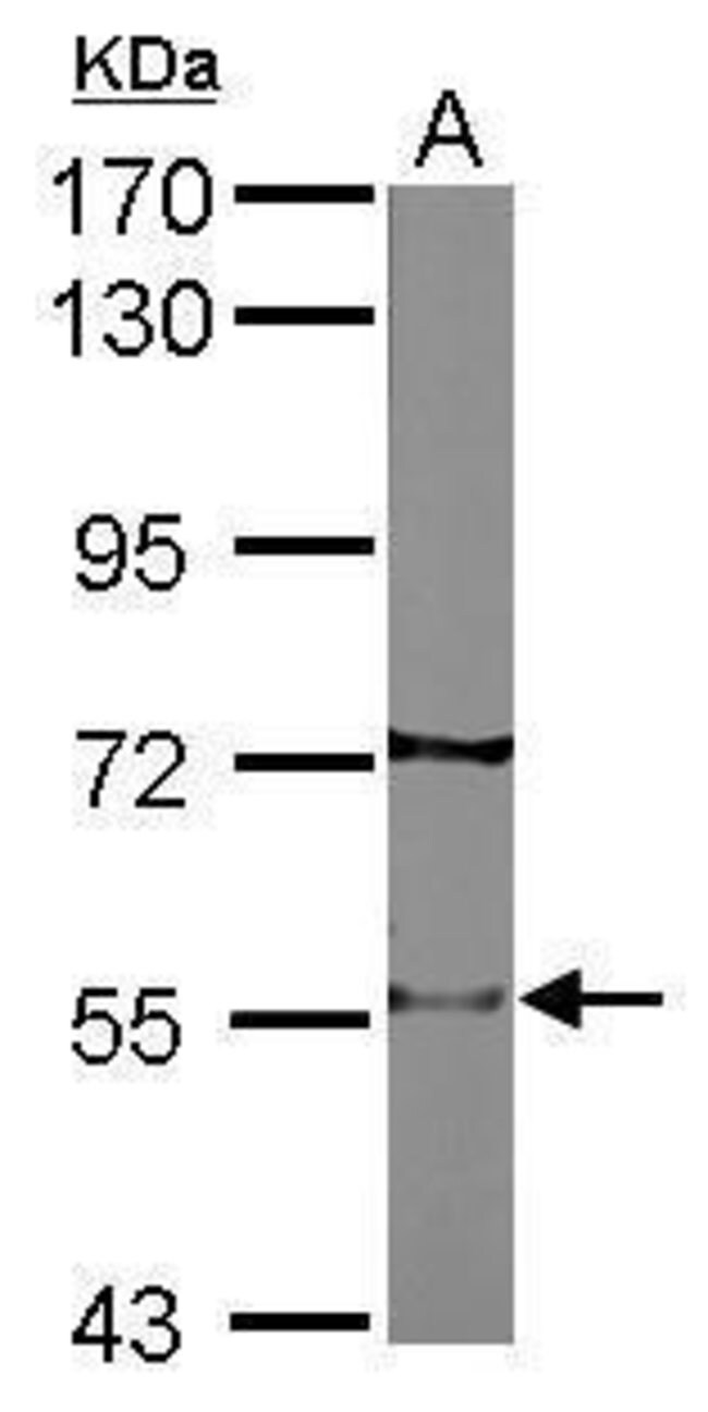 ANTI-NICOTINIC ACETYLCHOLINE RECEPTOR BE