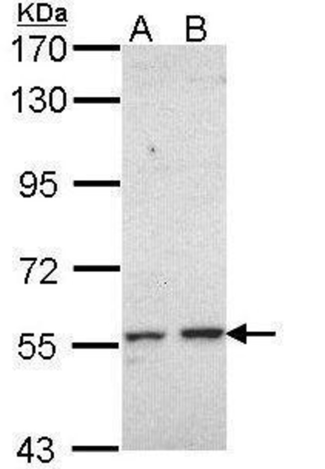 ANTI-CYTOCHROME P450 17A1