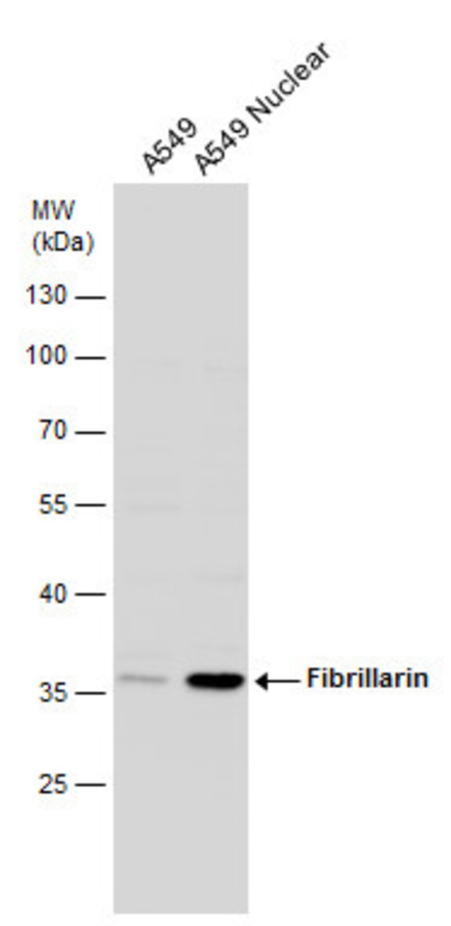 ANTI-FIBRILLARIN