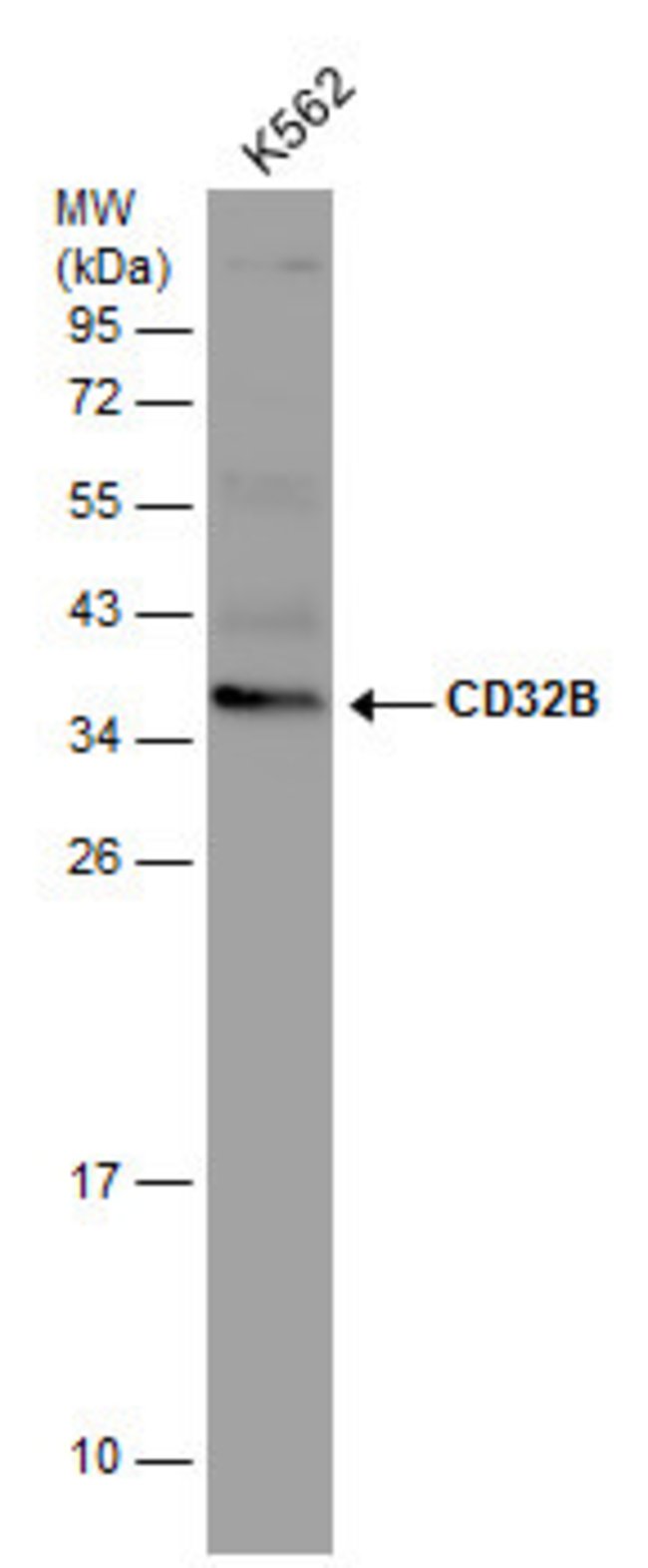 ANTI-CD32B