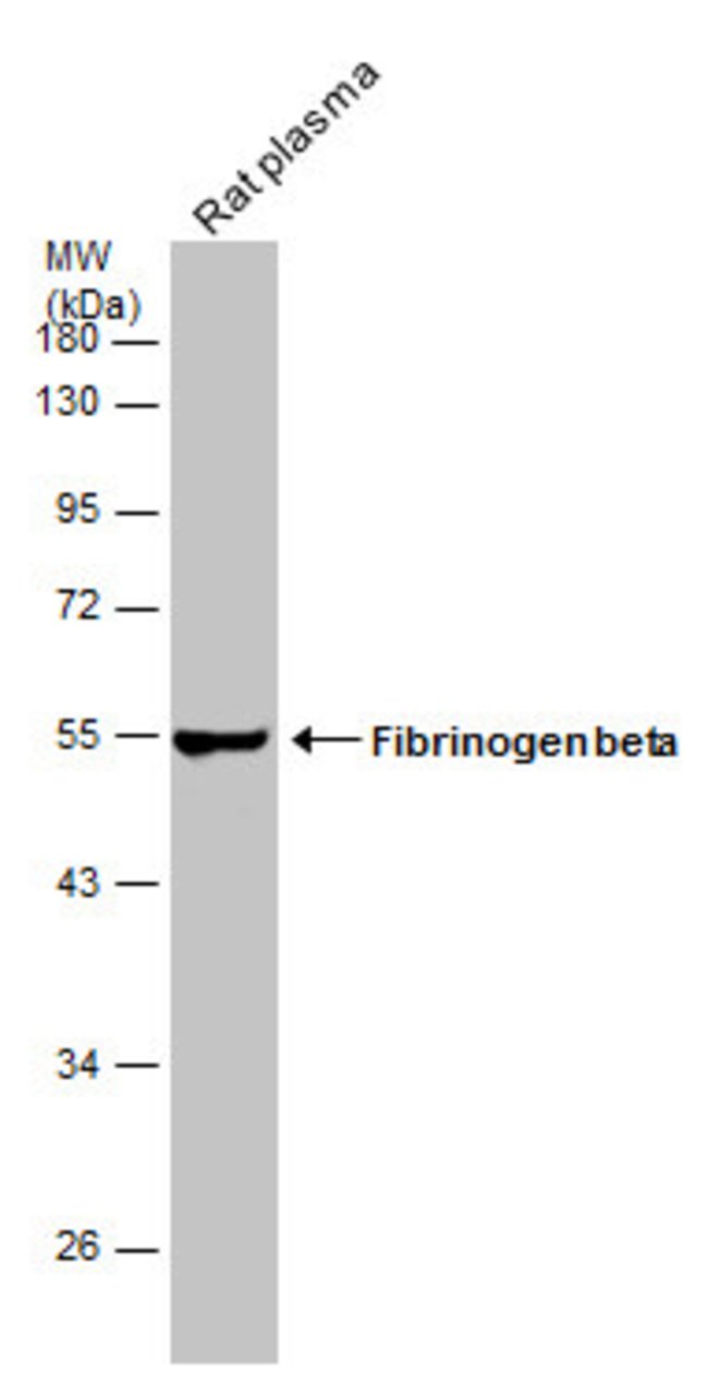 ANTI-FIBRINOGEN BETA