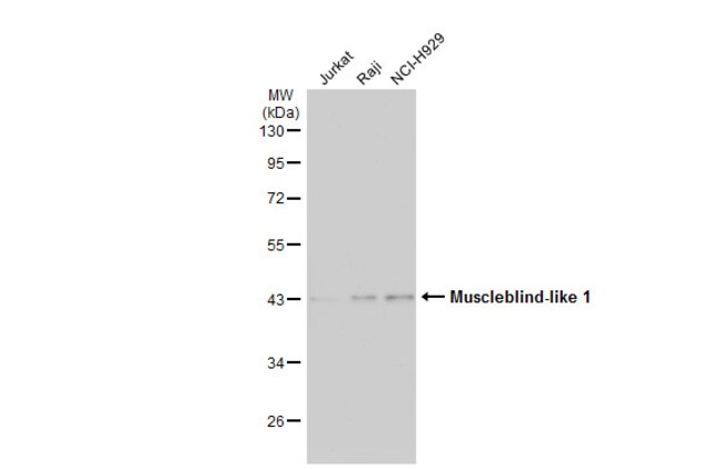 ANTI-MUSCLEBLIND-LIKE 1