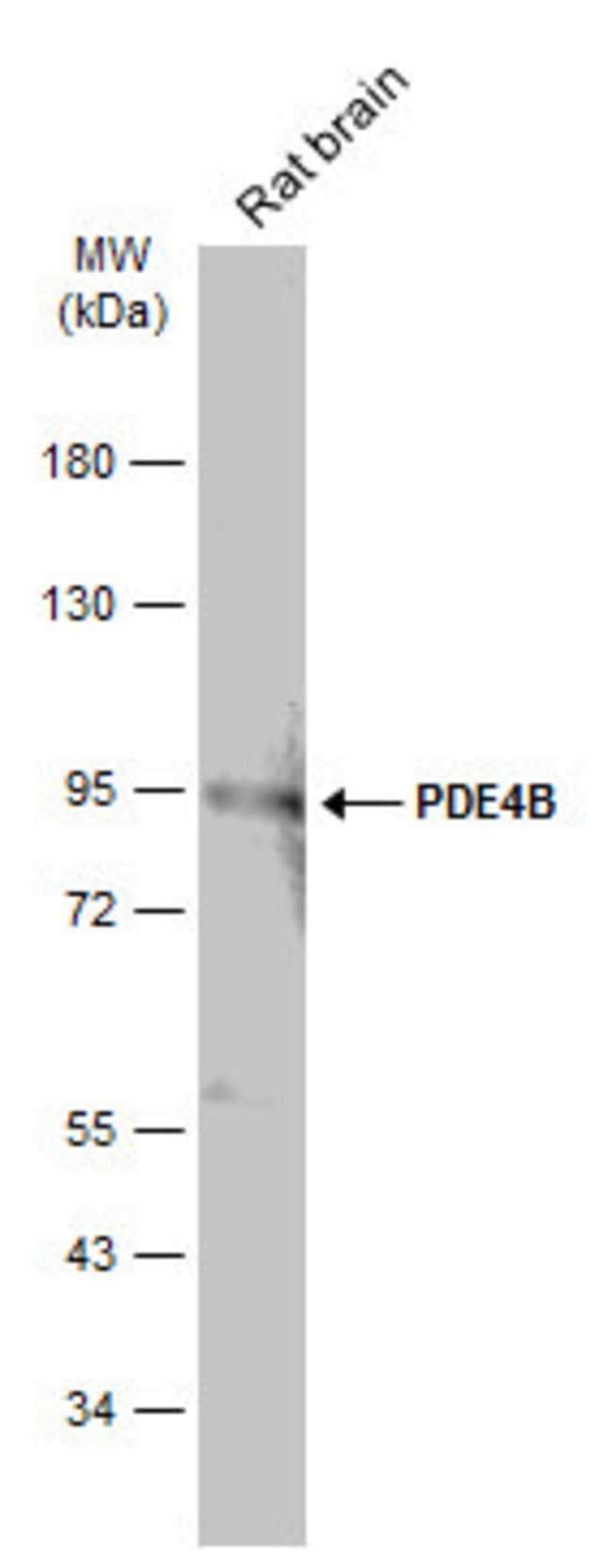 ANTI-PDE4B