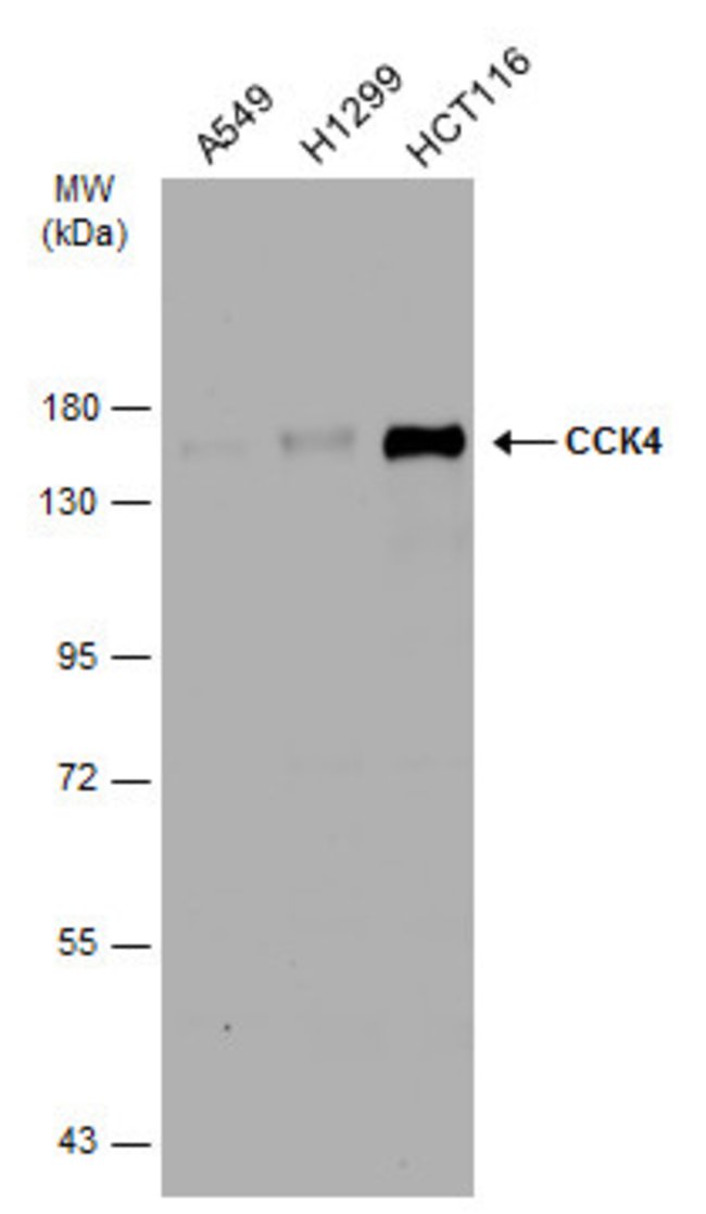 ANTI-CCK4