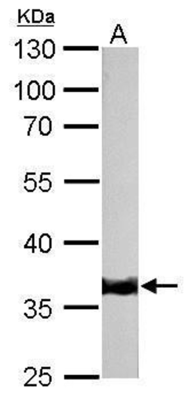 ANTI-TROPOMYOSIN 1