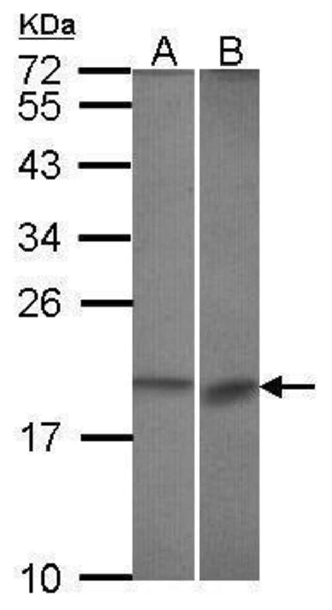 ANTI-BCL-B