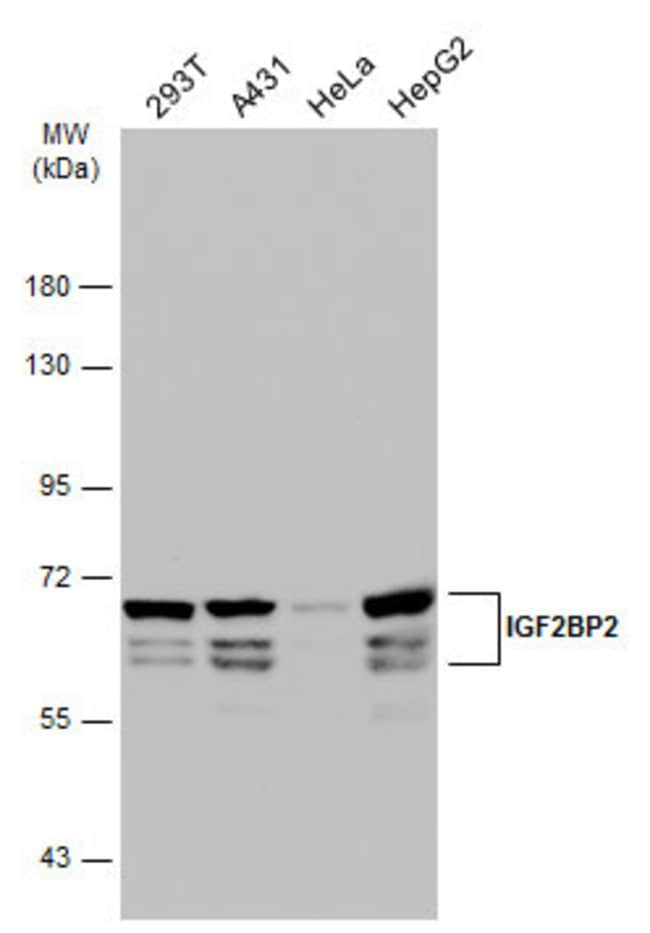 ANTI-IGF2BP2