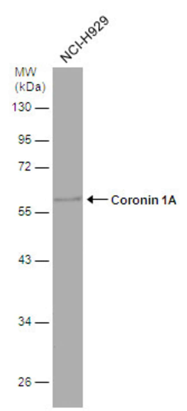 ANTI-CORONIN 1A