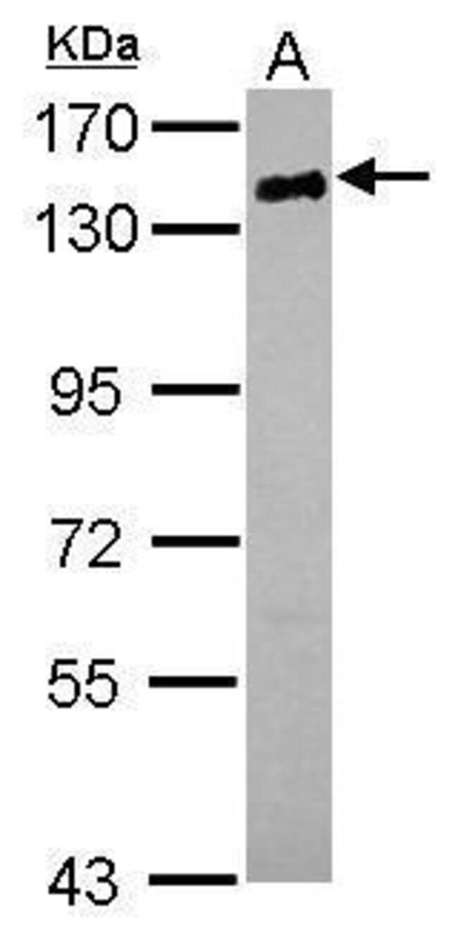 ANTI-CD22