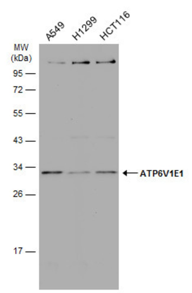 ANTI-ATP6V1E1