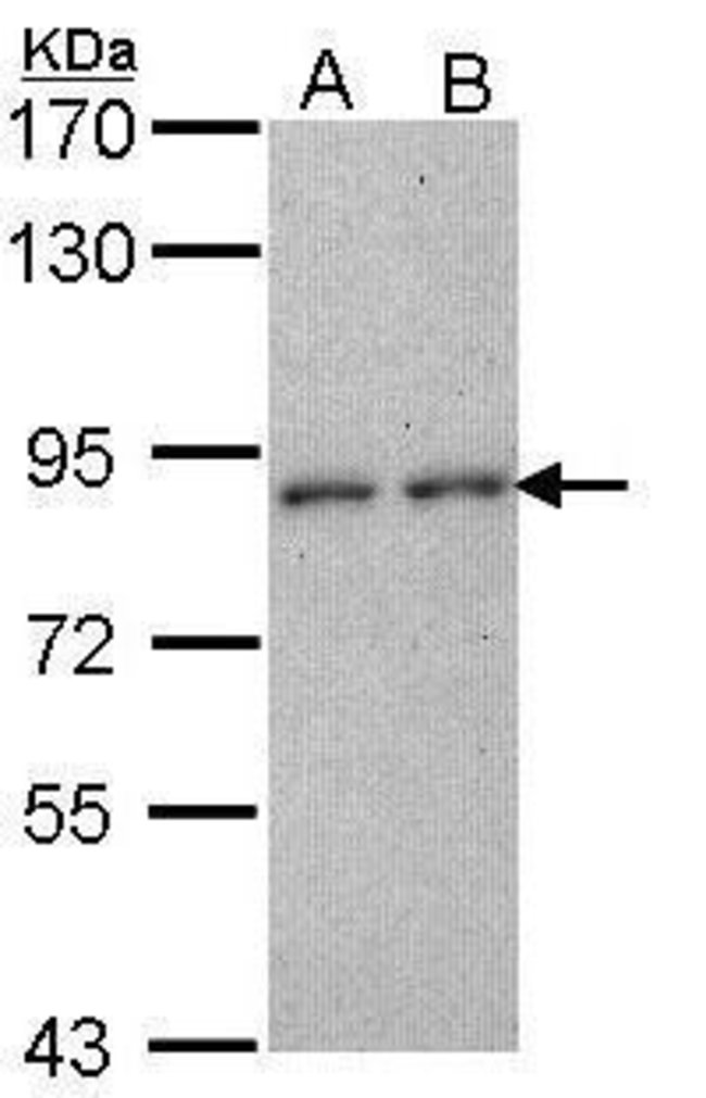 ANTI-CD6