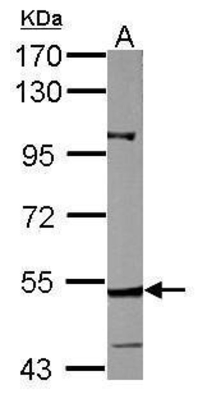 ANTI-CYP27A1