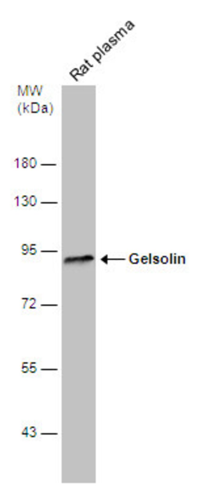 ANTI-GELSOLIN