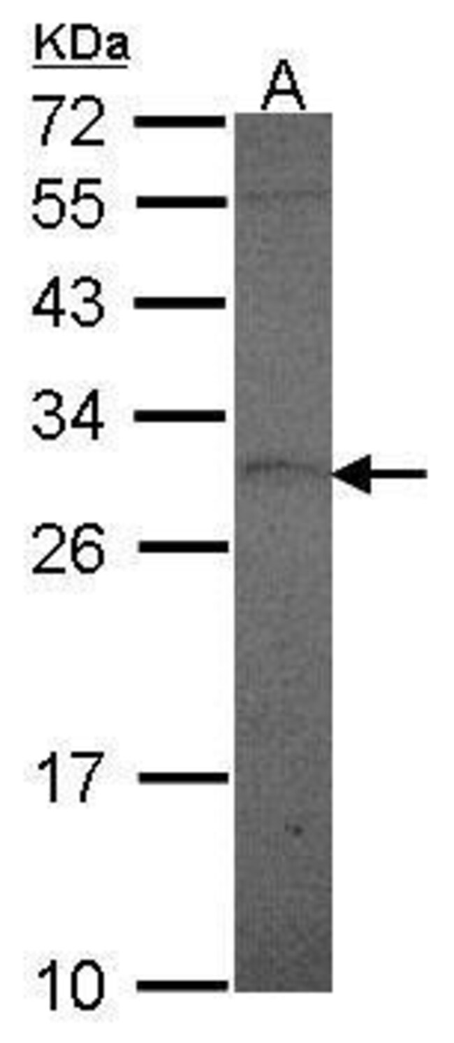 ANTI-PROLACTIN