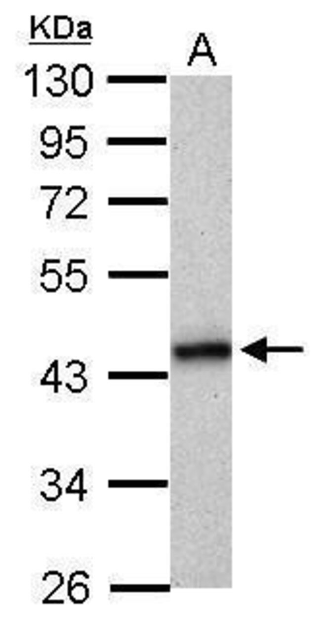 ANTI-HLA-B