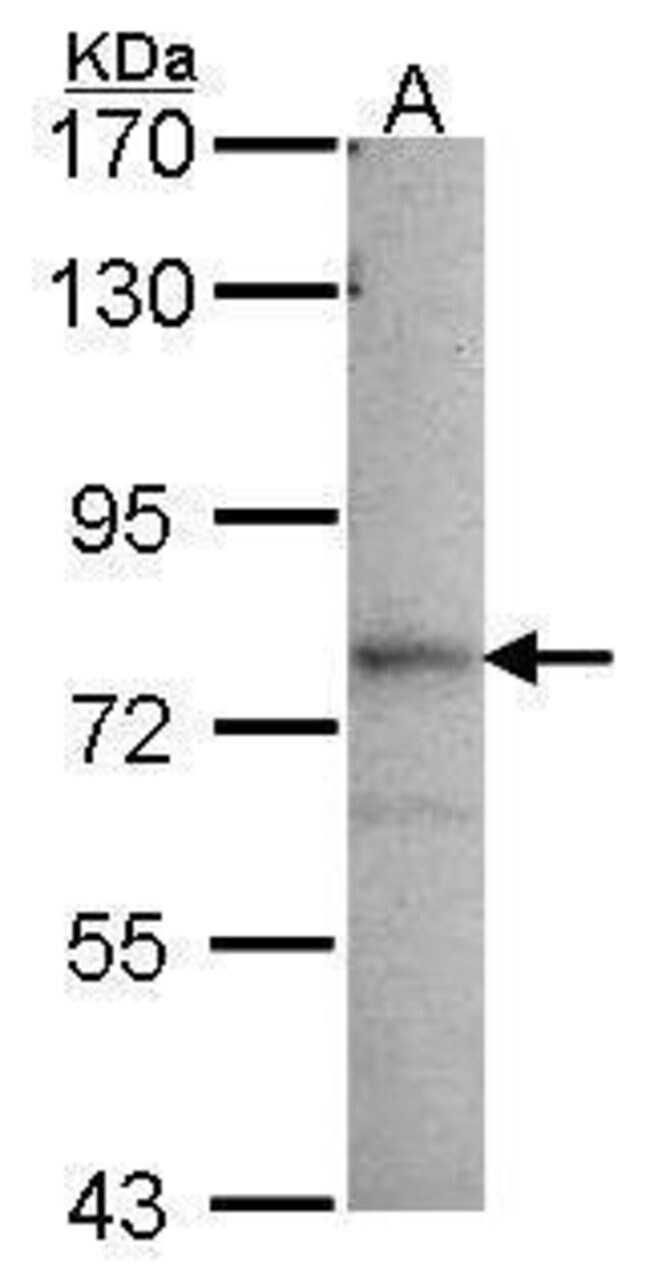 ANTI-GMP SYNTHASE