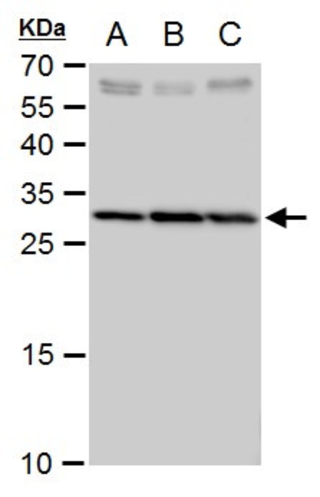 ANTI-SLC25A6