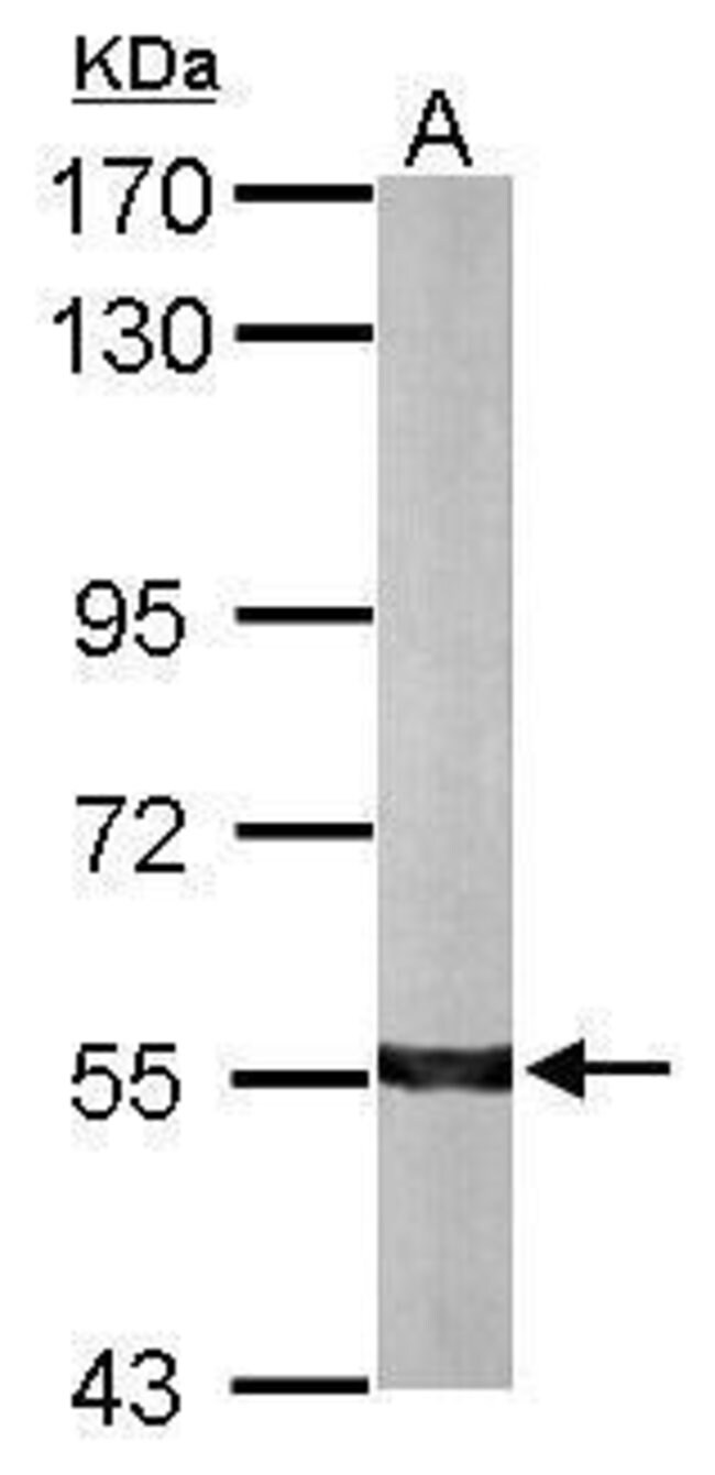 ANTI-ALDH7A1