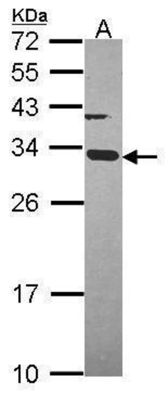 ANTI-ATP SYNTHASE GAMMA