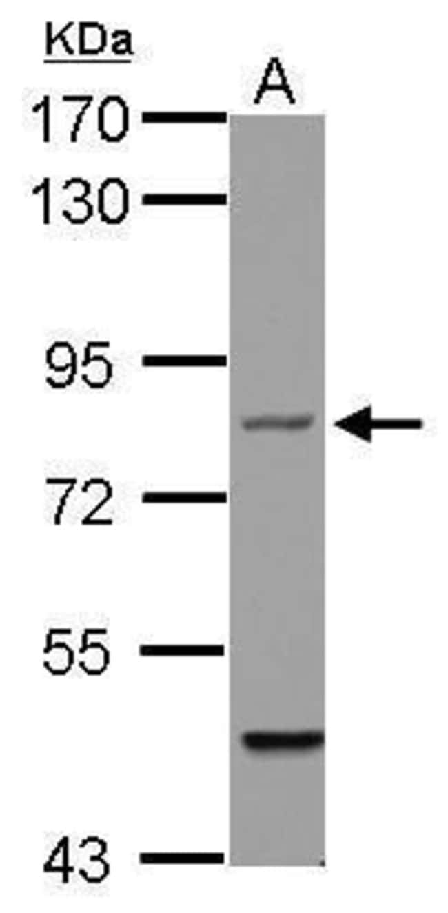 ANTI-FILENSIN