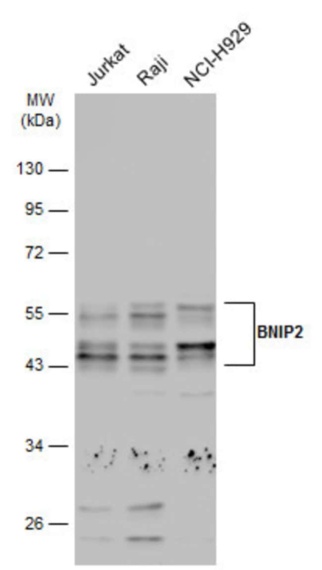 ANTI-BNIP2