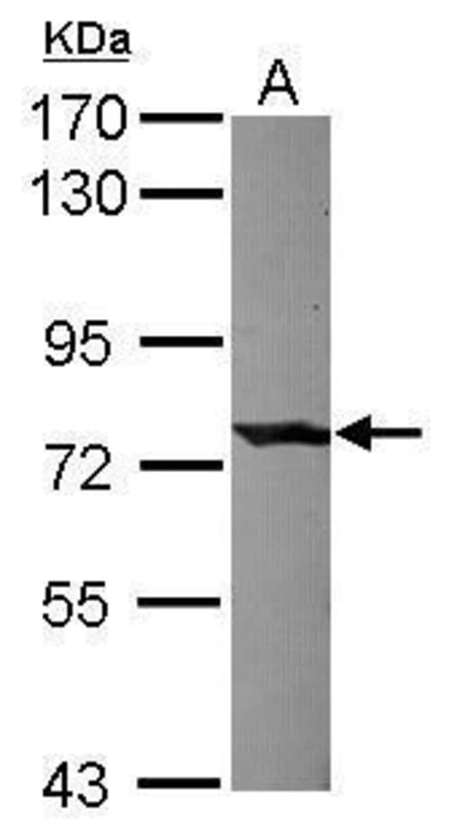 ANTI-COMPLEMENT C1S