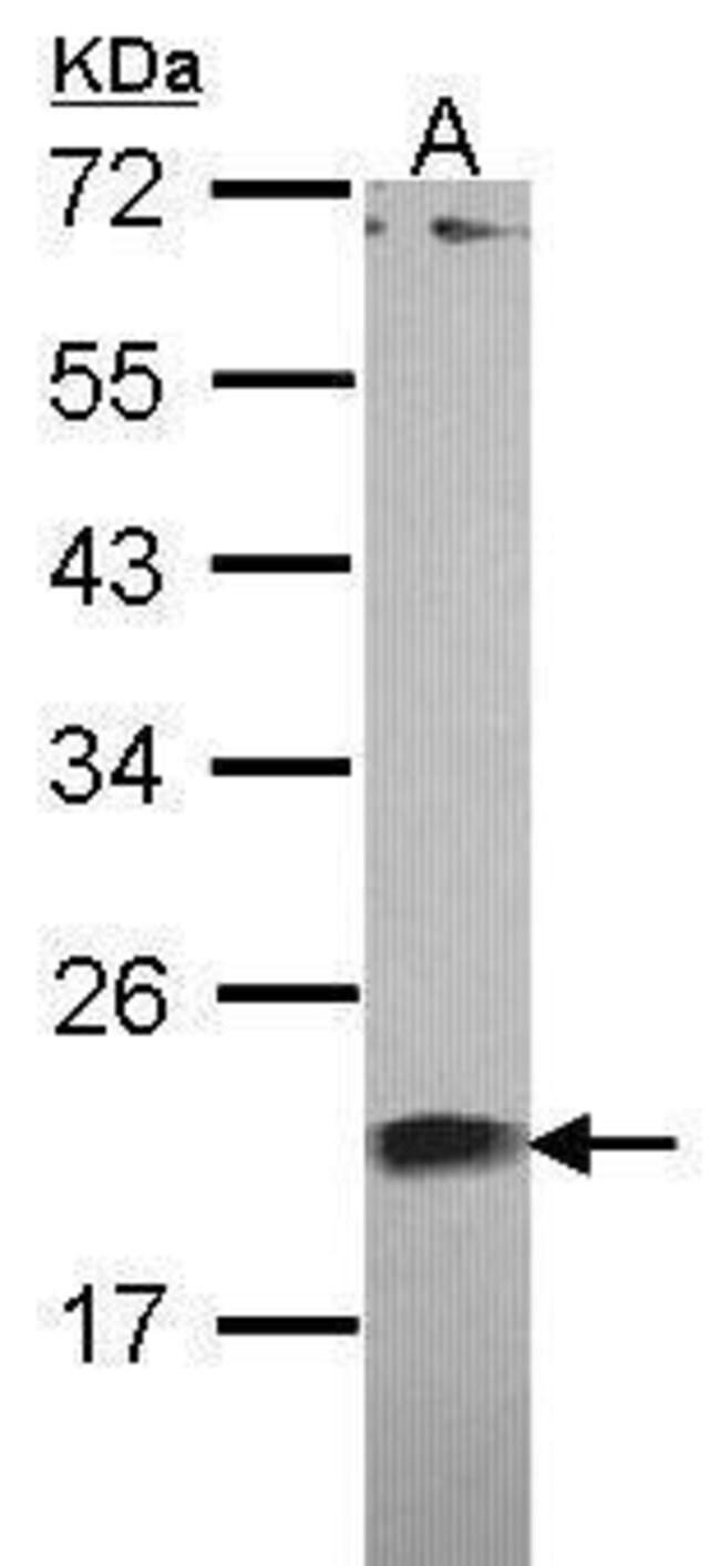 ANTI-CENTRIN-1