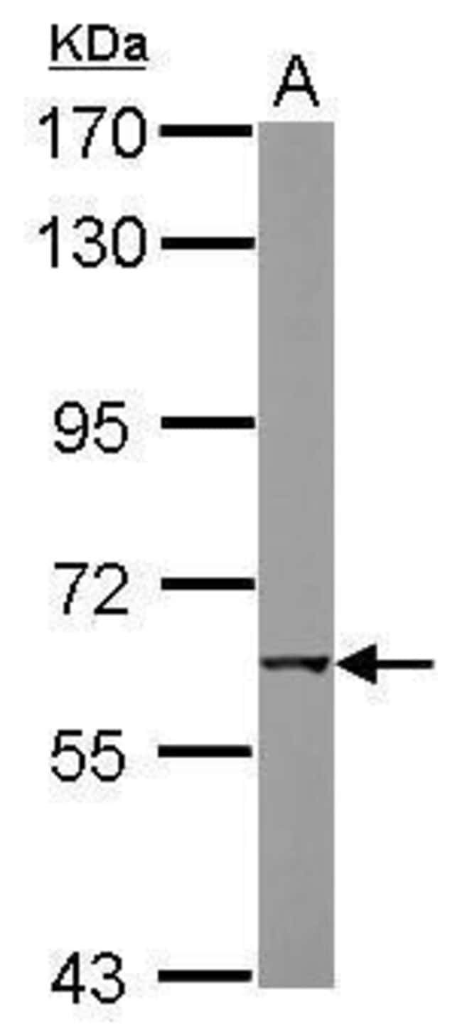 ANTI-NICOTINIC ACETYLCHOLINE RECEPTOR BE