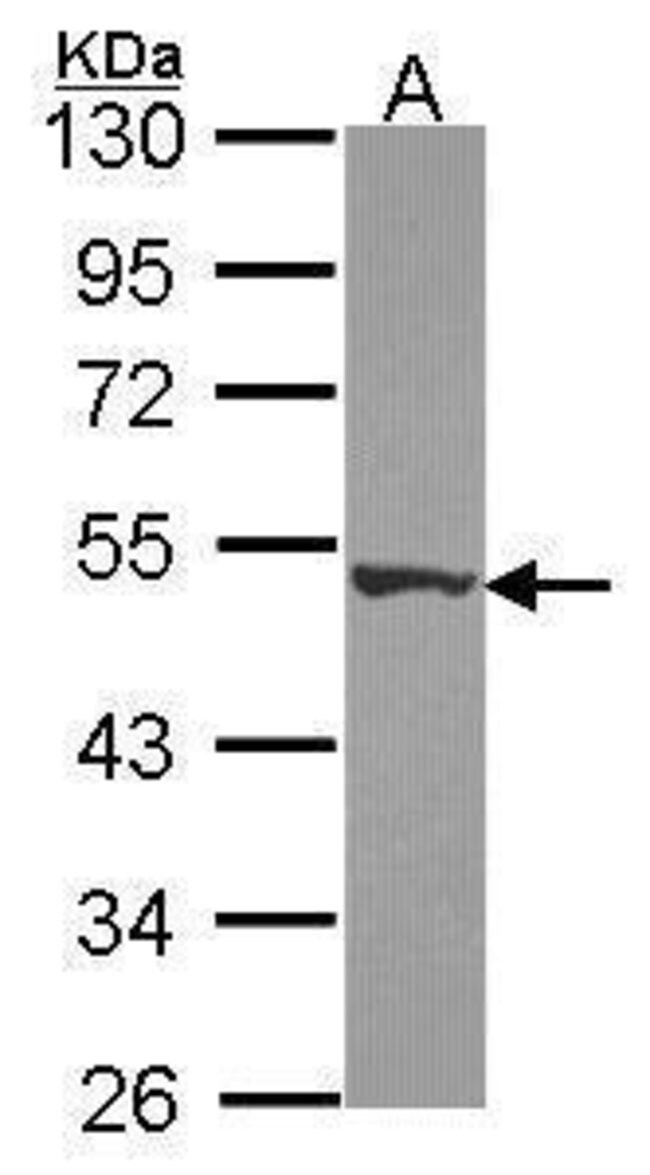 ANTI-DPH2