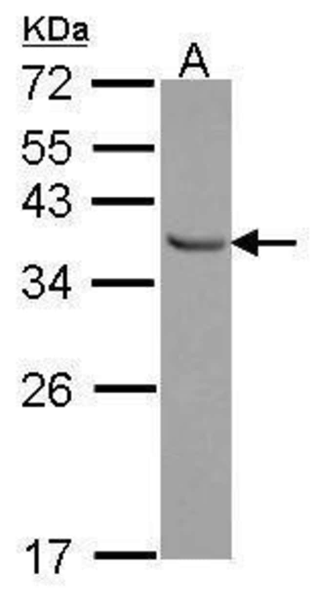 ANTI-E2F6