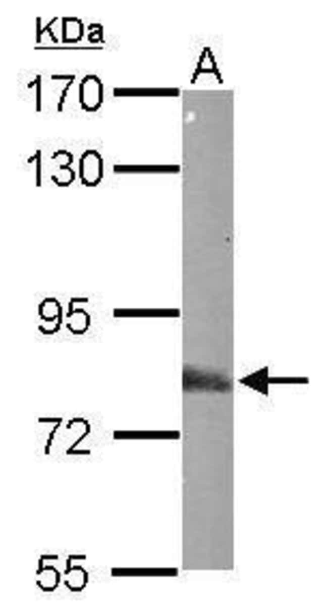 ANTI-EML1