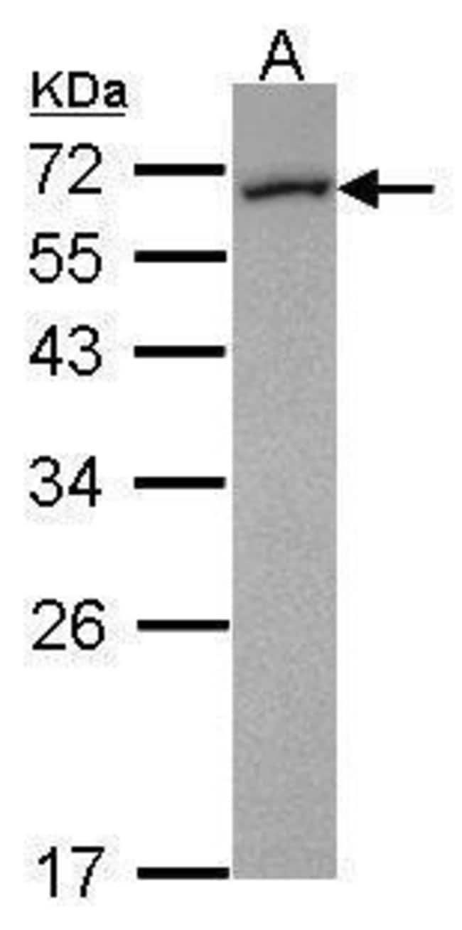 ANTI-FMO5