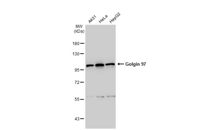 ANTI-GOLGIN 97