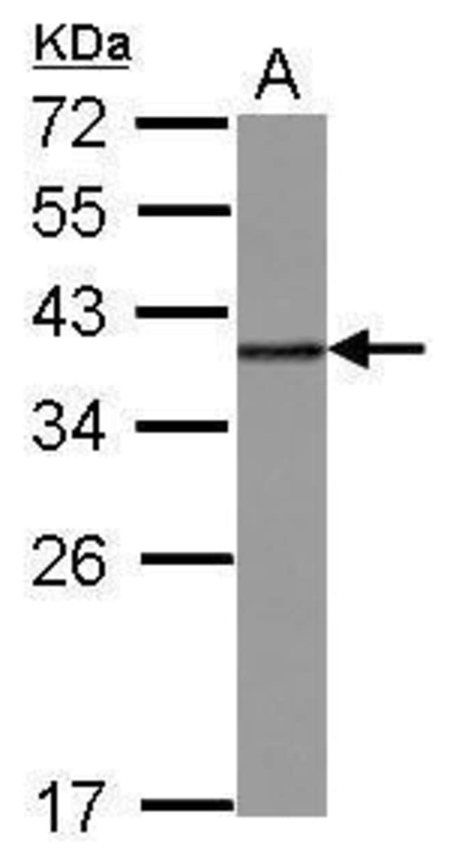 ANTI-HNRNP A2B1